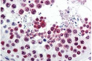 Human Testis (formalin-fixed, paraffin-embedded) stained with ATF6 antibody ABIN351434 at 5 ug/ml followed by biotinylated goat anti-rabbit IgG secondary antibody ABIN481713, alkaline phosphatase-streptavidin and chromogen. (ATF6 抗体  (C-Term))