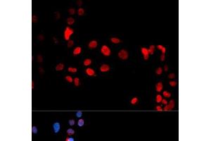 Immunofluorescence analysis of U2OS cells using Phospho-MAX(S11) Polyclonal Antibody (MAX 抗体  (pSer11))