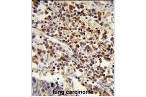 Immunohistochemistry (Paraffin-embedded Sections) (IHC (p)) image for anti-U2 Small Nuclear RNA Auxiliary Factor 1 (U2AF1) (AA 99-125) antibody (ABIN389305)
