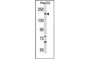 Western blot analysis of NTE Antibody (C-term) in HepG2 cell line lysates (35ug/lane). (PNPLA6 抗体  (C-Term))