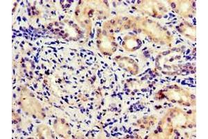 Immunohistochemistry of paraffin-embedded human kidney tissue using ABIN7171522 at dilution of 1:100