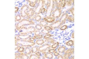 Immunohistochemistry of paraffin-embedded rat kidney using GOT1 antibody at dilution of 1:200 (400x lens). (GOT1 抗体)