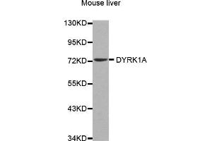 Western Blotting (WB) image for anti-Dual-Specificity tyrosine-(Y)-phosphorylation Regulated Kinase 1A (DYRK1A) (AA 624-763) antibody (ABIN6213900) (DYRK1A 抗体  (AA 624-763))