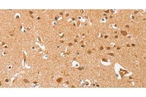 Immunohistochemistry of paraffin-embedded Human brain using AHSG Polyclonal Antibody at dilution of 1:60 (Fetuin A 抗体)