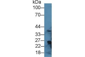 Western blot analysis of Rat Liver lysate, using Rat RGN Antibody (1 µg/ml) and HRP-conjugated Goat Anti-Rabbit antibody ( (Regucalcin 抗体  (AA 1-299))