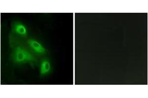 Immunofluorescence analysis of HeLa cells, using EPS8L3 Antibody. (EPS8-Like 3 抗体  (AA 401-450))