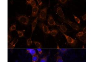 Immunofluorescence analysis of NIH-3T3 cells using VPS25 Polyclonal Antibody at dilution of 1:100 (40x lens). (VPS25 抗体)