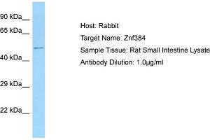 Host: Rabbit Target Name: ZNF384 Sample Tissue: Rat Small Intestine Antibody Dilution: 1ug/ml (ZNF384 抗体  (N-Term))