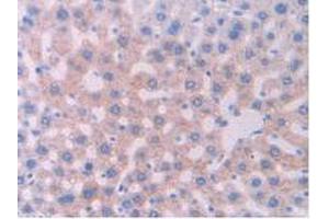 IHC-P analysis of Rat Liver Tissue, with DAB staining. (CYP1A1 抗体  (AA 251-521))