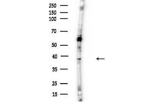 Western blot analysis of lysates from Mouse brain, using RFC3 Antibody at 1/1000 dilution.