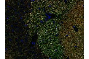 Indirect immunostaining of PFA fixed paraffin embedded mouse hippocampus section with anti-Piccolo (dilution 1 : 500; green) and rabbit anti-Homer 1 (cat. (Piccolo 抗体  (AA 2011-2350))