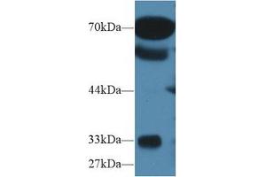 Western blot analysis of Human Serum, using Human OS9 Antibody (1 µg/ml) and HRP-conjugated Goat Anti-Rabbit antibody ( (OS9 抗体  (AA 466-667))
