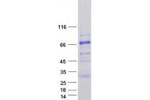 Western Blotting (WB) image for Testis-Specific Kinase 2 (TESK2) protein (Myc-DYKDDDDK Tag) (ABIN2733431)