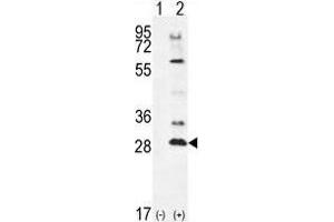 Western blot analysis of TSSK4 (arrow) using rabbit polyclonal TSSK4 Antibody (C-term) . (TSSK4 抗体  (C-Term))