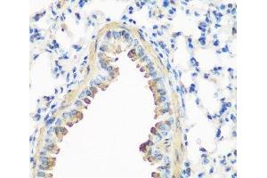 Immunohistochemistry of paraffin-embedded Mouse lung using CAV3 Polyclonal Antibody at dilution of 1:200 (40x lens). (Caveolin 3 抗体)