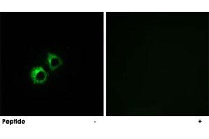 Immunofluorescence analysis of MCF-7 cells, using MRPS21 polyclonal antibody . (MRPS21 抗体)
