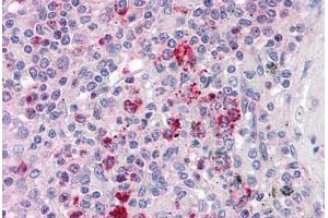 Human Spleen: Formalin-Fixed, Paraffin-Embedded (FFPE)