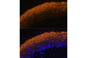 Immunofluorescence analysis of mouse skin using SPRR1A antibody (ABIN7270369) at dilution of 1:100. (SPRR1A 抗体)