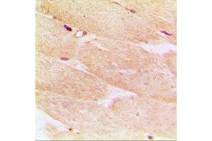 Immunohistochemical analysis of Alpha-actin-1 staining in human muscle formalin fixed paraffin embedded tissue section.