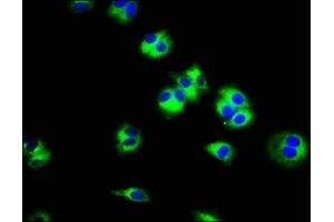 Immunofluorescence staining of HepG2 cells with ABIN7170259 at 1:100, counter-stained with DAPI. (SLC45A3 抗体  (AA 408-487))