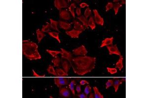 Immunofluorescence analysis of HeLa cells using TCAP Polyclonal Antibody (TCAP 抗体)
