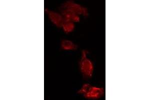 ABIN6275652 staining  HeLa cells by IF/ICC. (USP15 抗体  (N-Term))