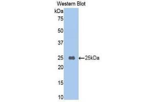 Western Blotting (WB) image for anti-Carboxypeptidase B2 (Plasma) (CPB2) (AA 187-327) antibody (ABIN1860680) (CPB2 抗体  (AA 187-327))