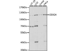 Western blot analysis of extracts of various cell lines, using DDX24 antibody. (DDX24 抗体)