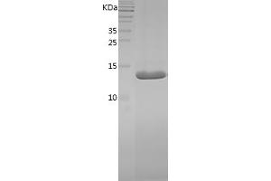 PMP2 Protein (AA 2-132) (His tag)