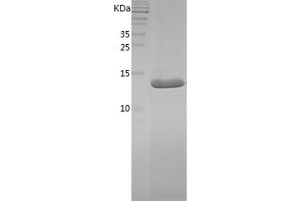 PMP2 Protein (AA 2-132) (His tag)