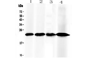 Western blot analysis of RBP4 using anti-RBP4 antibody . (RBP4 抗体  (AA 19-201))