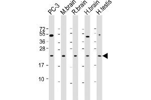 RAB18 Antikörper  (AA 1-206)