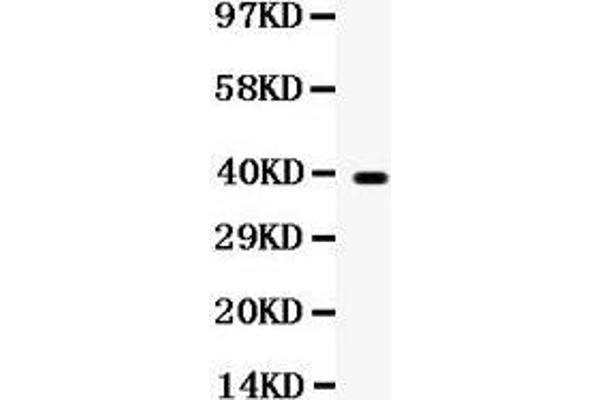 WNT7A 抗体  (C-Term)