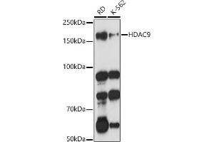 Western blot analysis of extracts of various cell lines, using HD antibody (ABIN3022053, ABIN3022054, ABIN3022055 and ABIN6218586) at 1:1000 dilution. (HDAC9 抗体  (AA 1-100))
