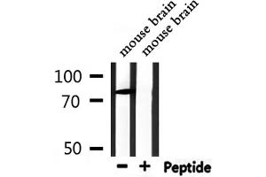 Western blot analysis of extracts from mouse brain, using CHFR Antibody. (CHFR 抗体)