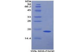 SDS-PAGE analysis of Mouse a2PI Protein. (alpha 2 Antiplasmin 蛋白)