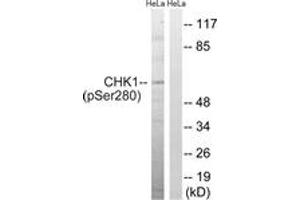 Western blot analysis of extracts from HeLa cells treated with Hu 2nM 24hours, using Chk1 (Phospho-Ser280) Antibody. (CHEK1 抗体  (pSer280))