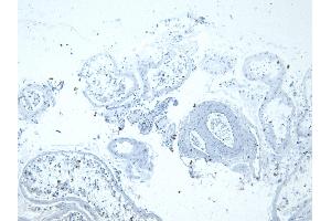 (ABIN302133) Negative Control showing staining of paraffin embedded Human Testis, with no primary antibody. (Lactate Dehydrogenase C 抗体  (AA 221-233))