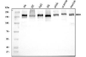 Western blot analysis of DROSHA using anti-DROSHA antibody (ABIN7599763).