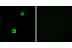 Peptide - +Immunohistochemistry analysis of paraffin-embedded human colon carcinoma tissue using CST1 antibody. (CST1 抗体)