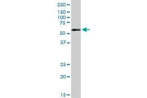 Western Blotting (WB) image for anti-Vaccinia Related Kinase 2 (VRK2) (AA 1-508) antibody (ABIN950130)