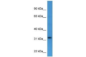 Western Blotting (WB) image for anti-Docking Protein 4 (DOK4) (C-Term) antibody (ABIN2788378) (DOK4 抗体  (C-Term))