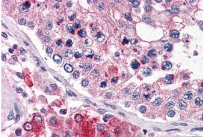 Human Testis (formalin-fixed, paraffin-embedded) stained with TMC6 antibody ABIN343905 at 5 ug/ml followed by biotinylated goat anti-rabbit IgG secondary antibody ABIN481713, alkaline phosphatase-streptavidin and chromogen. (TMC6 抗体  (N-Term))