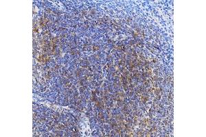 IHC analysis of TRIM6 using anti-TRIM6 antibody (ABIN7601905).