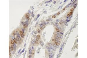 Immunohistochemistry (IHC) image for anti-Interferon Regulatory Factor 3 (IRF3) (AA 100-150) antibody (ABIN7448610)