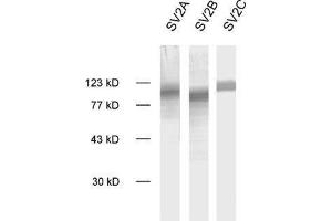 dilution: 1 : 1000, sample: crude synaptic vesicle fraction of rat brain (LP2) (SV2C 抗体  (AA 2-16))