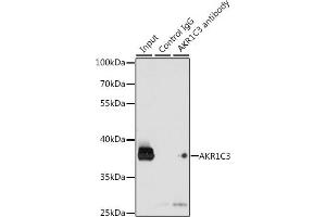 Immunoprecipitation analysis of 200 μg extracts of K-562 cells, using 3 μg C3 antibody (ABIN3022535, ABIN3022536, ABIN3022537 and ABIN6218888).