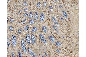 IHC analysis of EHD3 using anti-EHD3 antibody (ABIN7602777). (EHD3 抗体  (C-Term))