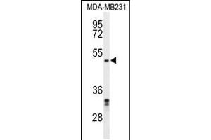 Western blot analysis of CBX2 Antibody in MDA-MB231 cell line lysates (35ug/lane) (CBX2 抗体  (N-Term))