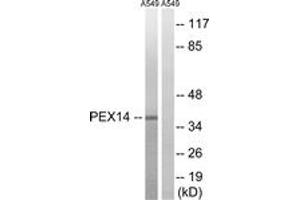 Western blot analysis of extracts from A549 cells, using PEX14 Antibody. (PEX14 抗体  (AA 117-166))